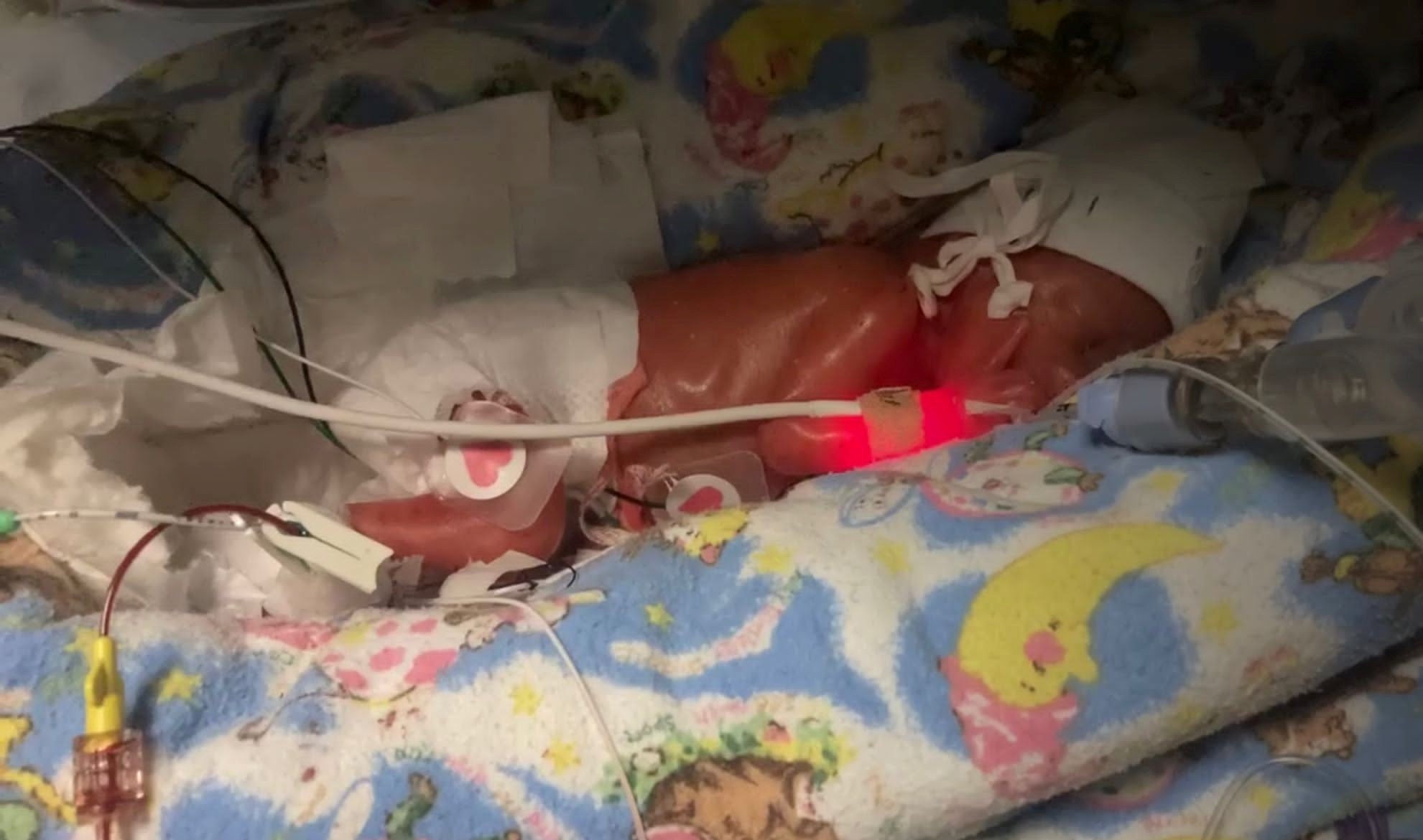 23 week old preemie sales